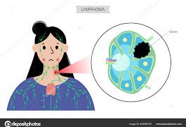 Understanding Malignant Lymphomas
